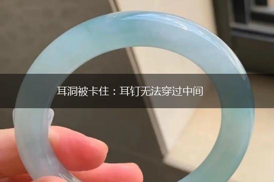 耳洞被卡住：耳钉无法穿过中间,第1张